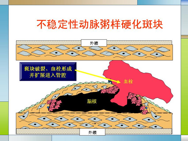 1509707919373040110.jpg 104.jpg